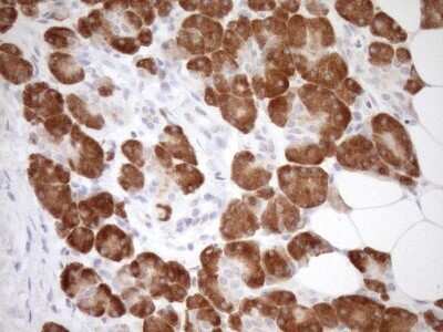 Immunohistochemistry: GEMIN8 Antibody (OTI1E5) - Azide and BSA Free [NBP2-71977]