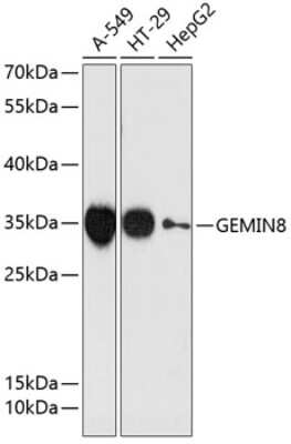 Western Blot: GEMIN8 AntibodyAzide and BSA Free [NBP3-04575]