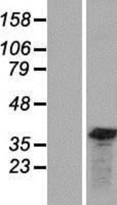 Western Blot: GEMIN8 Overexpression Lysate [NBP2-09232]