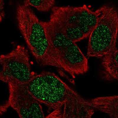 Immunocytochemistry/ Immunofluorescence: GEN1 Antibody [NBP2-30783]