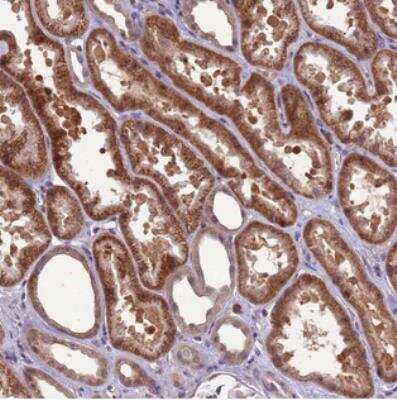 Immunohistochemistry-Paraffin: GEN1 Antibody [NBP2-30836]