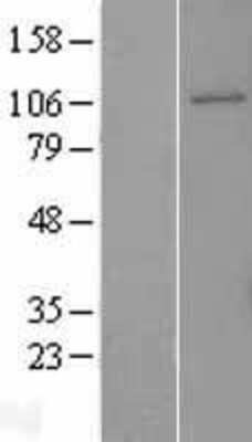 Western Blot: GEN1 Overexpression Lysate [NBL1-11042]