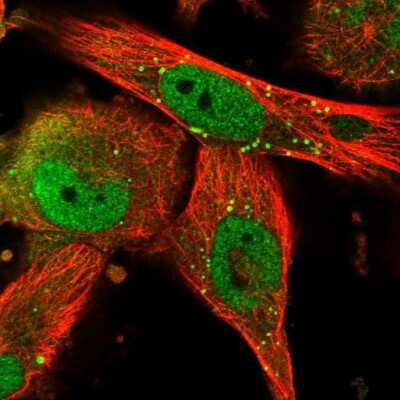Immunocytochemistry/ Immunofluorescence: TRIM8 Antibody [NBP1-89776]