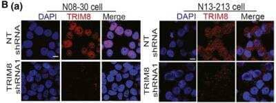 Knockdown Validated: TRIM8 Antibody [NBP1-89776]