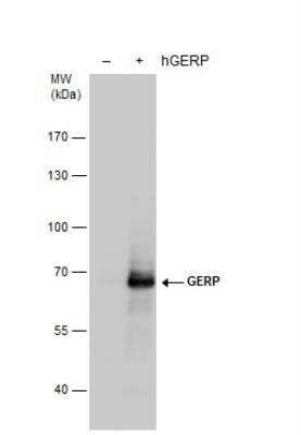 Western Blot: TRIM8 Antibody [NBP2-16642]