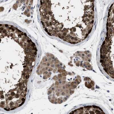 Immunohistochemistry-Paraffin: GET4 Antibody [NBP1-86732]