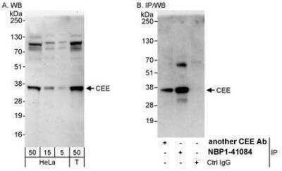 Western Blot: GET4 Antibody [NBP1-41084]