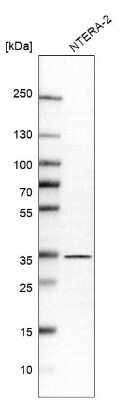 Western Blot: GET4 Antibody [NBP1-86732]