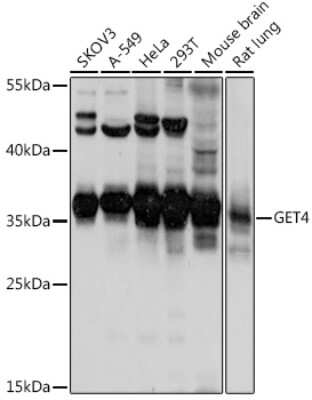 Western Blot: GET4 AntibodyAzide and BSA Free [NBP3-04677]