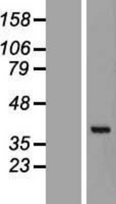 Western Blot: GET4 Overexpression Lysate [NBL1-08544]