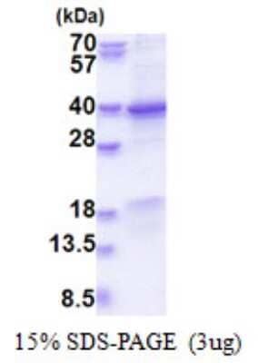 SDS-PAGE: Recombinant Human GET4 His Protein [NBP2-51574]