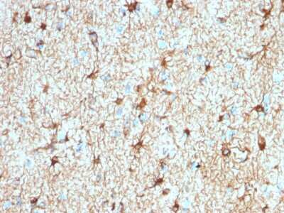 Immunohistochemistry-Paraffin: GFAP Antibody (ASTRO/1974R) [NBP3-07877]
