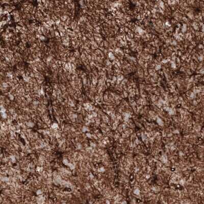 Immunohistochemistry-Paraffin: GFAP Antibody (CL2713) [NBP2-76477]