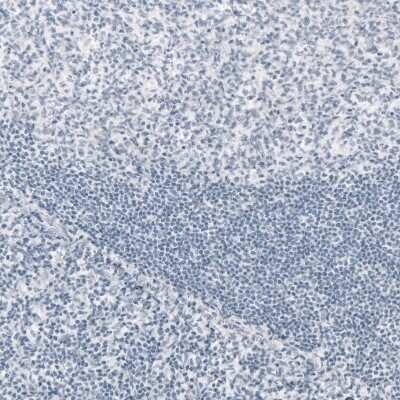 Immunohistochemistry-Paraffin: GFAP Antibody (CL2713) [NBP2-76477]