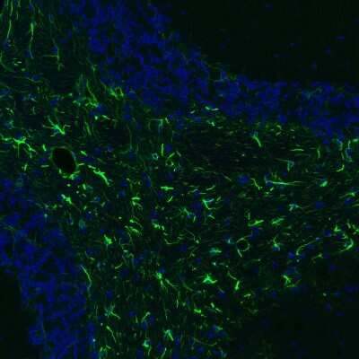 Immunohistochemistry-Paraffin: GFAP Antibody (CL2713) [NBP2-76477]