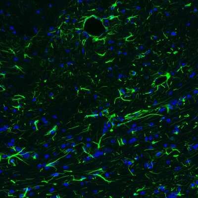 Immunohistochemistry-Paraffin: GFAP Antibody (CL2713) [NBP2-76477]