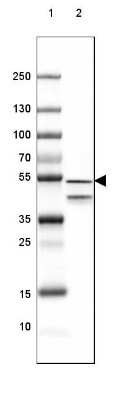 Western Blot: GFAP Antibody (CL2713) [NBP2-76477]