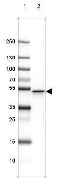 Western Blot: GFAP Antibody (CL2713) [NBP2-76477]