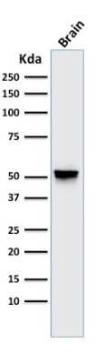 Western Blot: GFAP Antibody (GA-5)Azide and BSA Free [NBP2-33184]