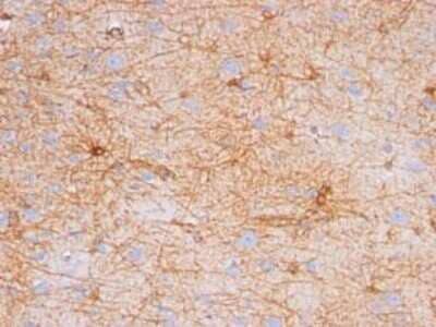 Immunohistochemistry-Paraffin: GFAP Antibody (GA-5) [NBP2-29415]