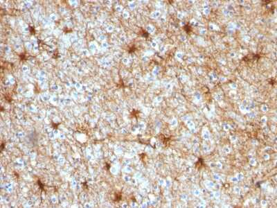 Immunohistochemistry-Paraffin: GFAP Antibody (GA-5) [NBP2-29415]