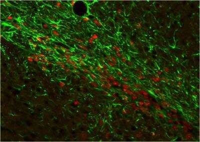 Immunohistochemistry: GFAP Antibody [NB300-141]