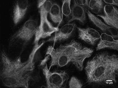 Immunocytochemistry/ Immunofluorescence: GFAP Antibody [NB300-141]