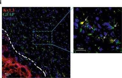 Immunocytochemistry/ Immunofluorescence: GFAP Antibody [NB300-141]