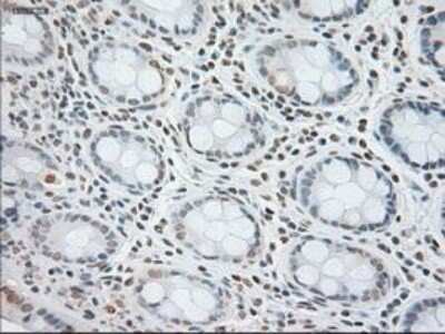 Immunohistochemistry-Paraffin: GFAP Antibody (OTI4D11) [NBP1-47782]