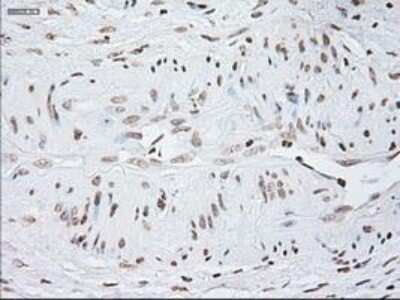 Immunohistochemistry-Paraffin: GFAP Antibody (OTI4D11) [NBP1-47782]