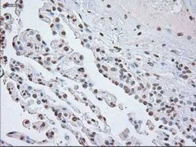 Immunohistochemistry-Paraffin: GFAP Antibody (OTI4D11) [NBP1-47782]