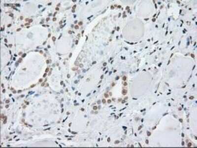 Immunohistochemistry-Paraffin: GFAP Antibody (OTI4D11) [NBP1-47782]