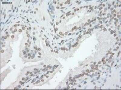 Immunohistochemistry-Paraffin: GFAP Antibody (OTI4D11) [NBP1-47782]