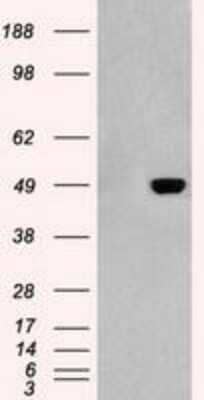 Western Blot: GFAP Antibody (OTI4D11) [NBP1-47782]