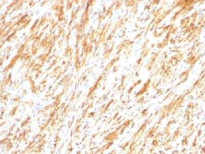Immunohistochemistry-Paraffin: GFAP Antibody (SPM248) [NBP2-34353]