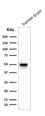 Western Blot: GFAP Antibody (SPM248) [NBP2-34353]