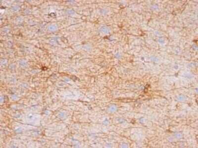 Immunohistochemistry-Paraffin: GFAP Antibody (SPM507) - Azide and BSA Free [NBP2-34413]