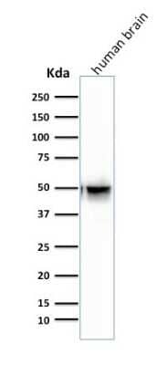 Western Blot: GFAP Antibody (SPM507) [NBP2-34365]