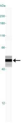 Simple Western: GFAP Antibody [NB300-141]