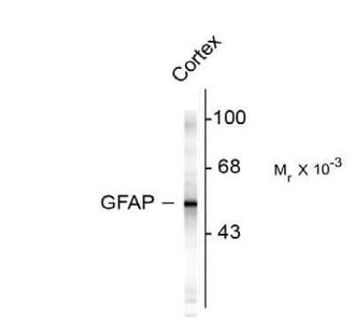 Western Blot: GFAP AntibodyAzide and BSA Free [NB110-93480]