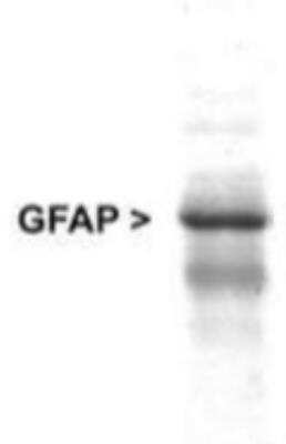 Western Blot: GFAP Antibody [NB300-141]
