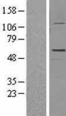 Western Blot: GFAP Overexpression Lysate [NBL1-11043]