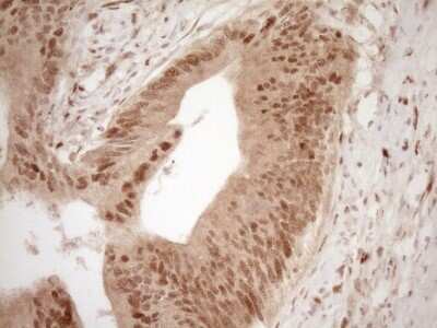 Immunohistochemistry: GFI-1 Antibody (OTI6E8) [NBP2-45833]
