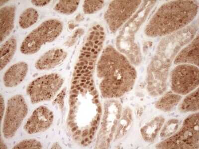 Immunohistochemistry: GFI-1 Antibody (OTI6E8) [NBP2-45833]