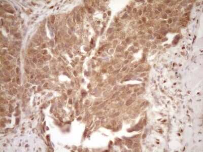 Immunohistochemistry: GFI-1 Antibody (OTI6E8) [NBP2-45833]