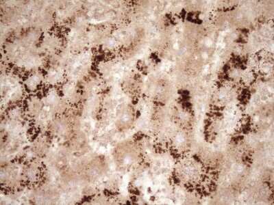 Immunohistochemistry: GFI-1 Antibody (OTI6E8) [NBP2-45833]