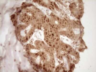 Immunohistochemistry: GFI-1 Antibody (OTI6E8) - Azide and BSA Free [NBP2-70827]