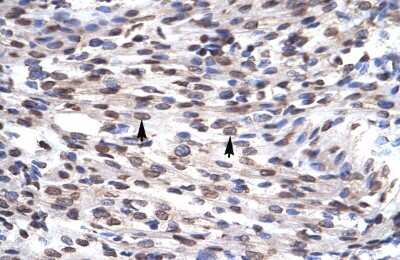 Immunohistochemistry-Paraffin: GFI1B Antibody [NBP2-84040]