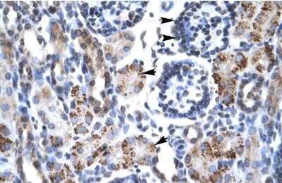 Immunohistochemistry-Paraffin: GFI1B Antibody [NBP2-84040]