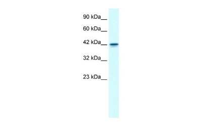 Western Blot: GFI1B Antibody [NBP2-84040]